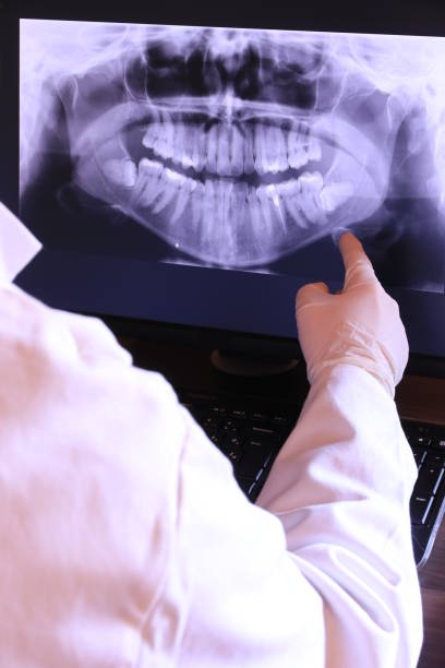 Best Broken or Cracked Tooth Emergency Dentist in Jefferson, OR